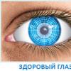 Silma astigmatism: sümptomid, põhjused, ravi