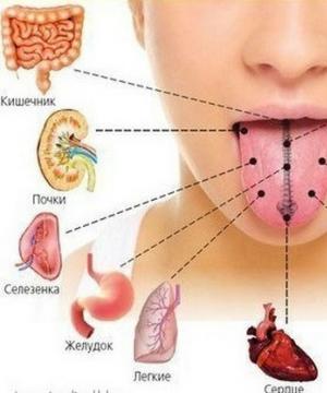 Tongue coated with white coating: symptoms, causes and treatment