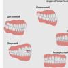 Malocclusion in a child: types, causes, treatment methods At what age does a child’s bite form?