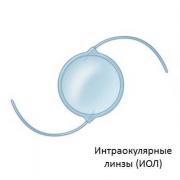 Lensa intraokular buatan: jenis, produsen, ulasan Jenis lensa intraokular