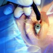 قطرات ترطيب العين بعد الجراحة - قطرات العين لجفاف العين والتعب والعلاج والتوصيات لحرق قطرات العين بعد تصحيح الرؤية